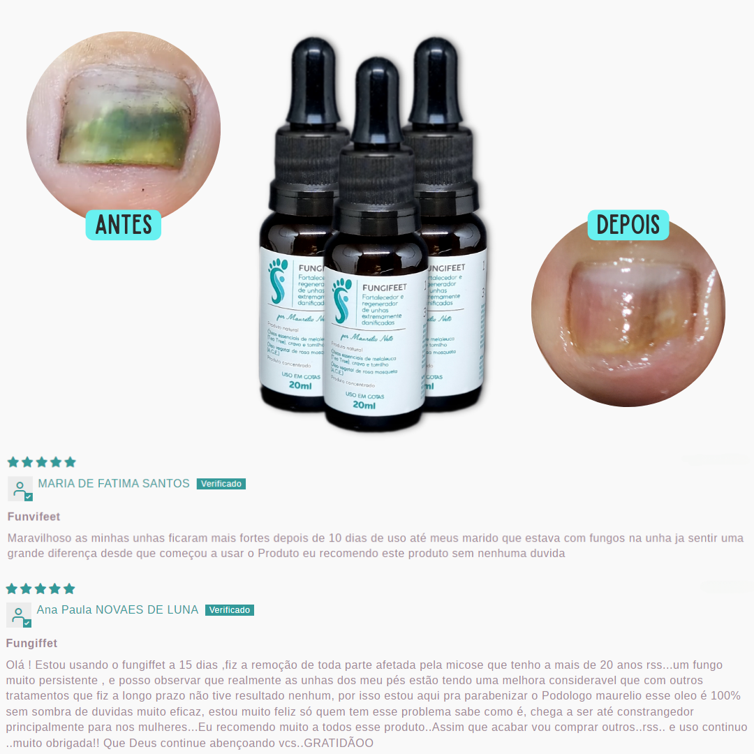 KIT FUNGIFEET (30) UNIDADES