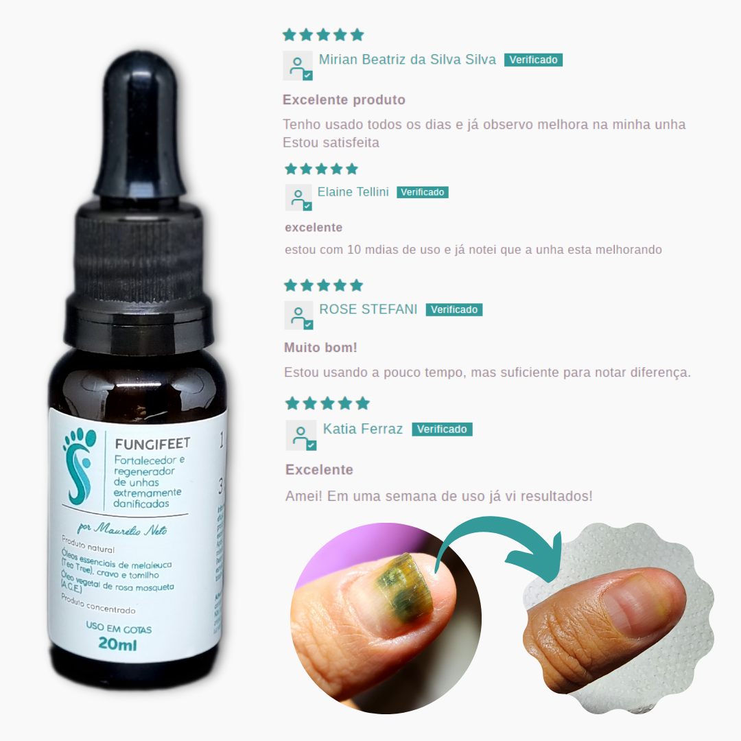 KIT FUNGIFEET (3) UNIDADES