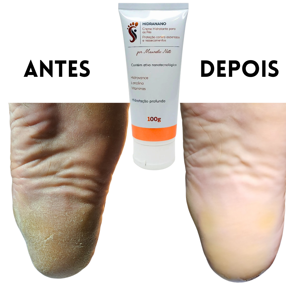 KIT SPA DOS PÉS FEET CLEAN (LOÇÃO) DERMO SOLUTION (EMOLIENTE) PODO CLEAN (DESODORANTE) HIDRANANO (CREME HIDRATANTE)