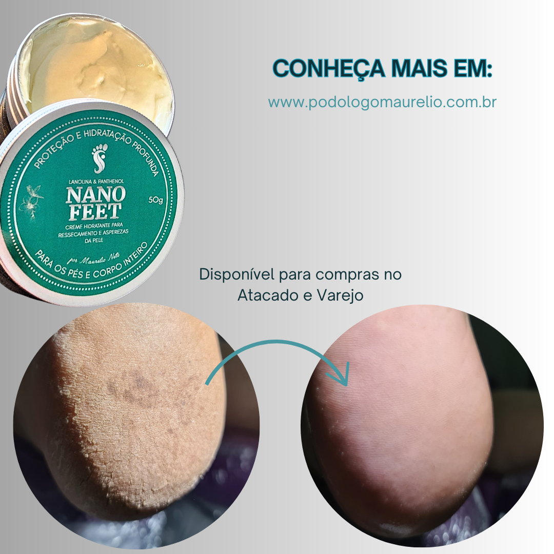 NANOFEET CREME PARA RACHADURAS E RESSECAMENTOS (3) UNIDADES